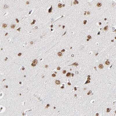 Immunohistochemistry-Paraffin: ILKAP/PP2C delta Antibody [NBP1-85117]