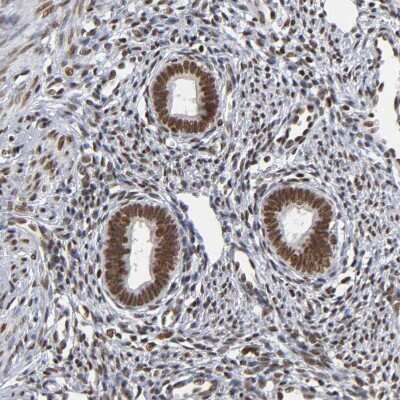 Immunohistochemistry-Paraffin: ILKAP/PP2C delta Antibody [NBP1-85117]