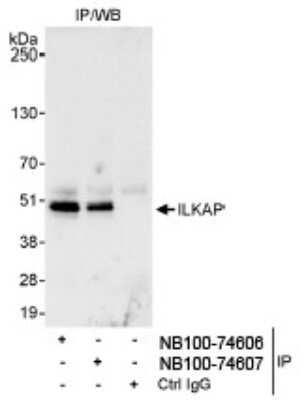 Immunoprecipitation: ILKAP/PP2C delta Antibody [NB100-74606]