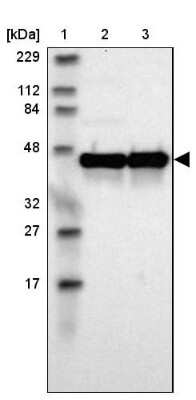 Western Blot: ILKAP/PP2C delta Antibody [NBP1-85117]