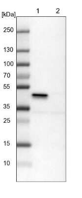 Western Blot: ILKAP/PP2C delta Antibody [NBP1-85117]