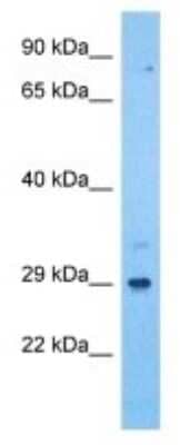 Western Blot: ILT11/LILRA5 Antibody [NBP3-10013]