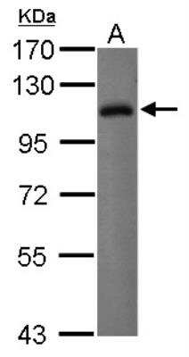 Western Blot: ILT2/CD85j/LILRB1 Antibody [NBP2-15014]