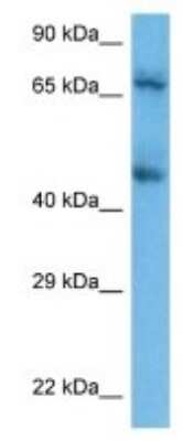 Western Blot: ILT3/CD85k/LILRB4 Antibody [NBP3-09945]