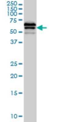 Western Blot: ILT4/CD85d/LILRB2 Antibody (1D4) [H00010288-M01]