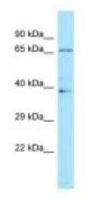 Western Blot: ILT4/CD85d/LILRB2 Antibody [NBP1-98554]