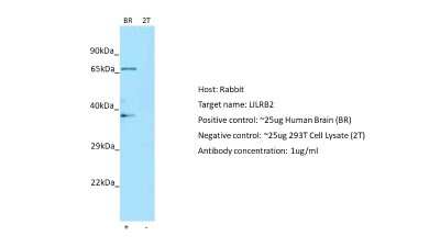 Western Blot: ILT4/CD85d/LILRB2 Antibody [NBP1-98554]