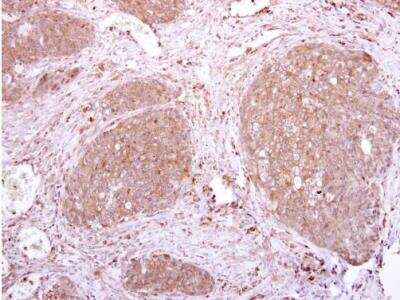 Immunohistochemistry-Paraffin: ILT6/CD85e/LILRA3 Antibody [NBP2-19351]