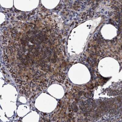 Immunohistochemistry-Paraffin: ILT7/CD85g/LILRA4 Antibody [NBP2-48932]