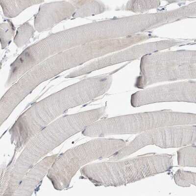 Immunohistochemistry-Paraffin: ILT7/CD85g/LILRA4 Antibody [NBP2-48932]