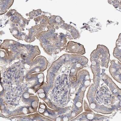 Immunohistochemistry-Paraffin: ILT7/CD85g/LILRA4 Antibody [NBP2-48932]