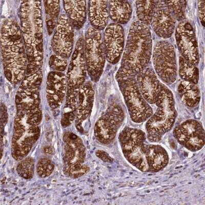Immunohistochemistry: ILVBL Antibody [NBP2-49524]