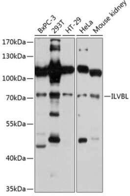 Western Blot: ILVBL AntibodyAzide and BSA Free [NBP3-05076]