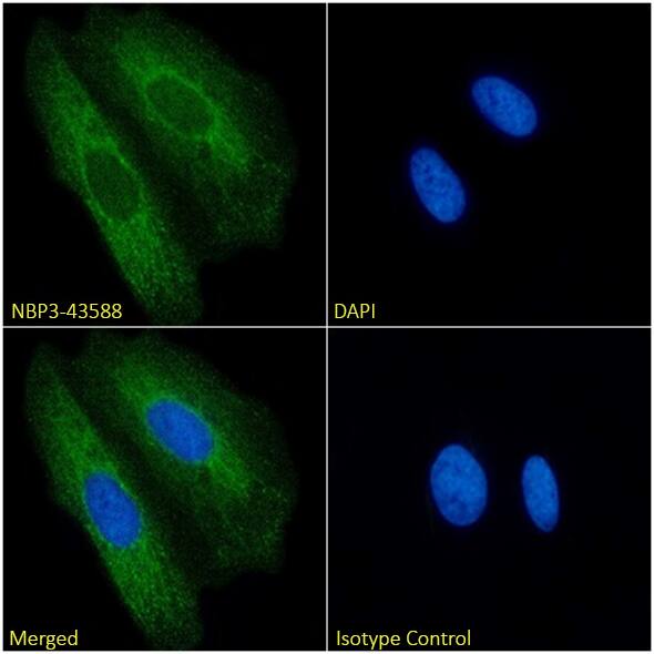 Cytokeratin 8/18 Antibody (COU-1) - Chimeric - BSA Free Cytokeratin 8/18 Antibody (COU-1) - Chimeric - BSA Free