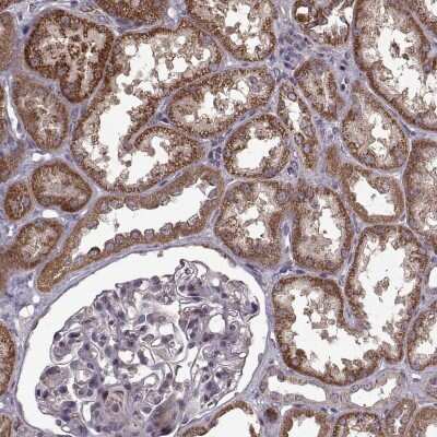 Immunohistochemistry-Paraffin: IMMP1L Antibody [NBP2-68738]