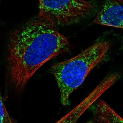 Immunocytochemistry/ Immunofluorescence: IMMP2L Antibody [NBP1-81591]