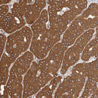Immunohistochemistry: IMMP2L Antibody [NBP1-81591]