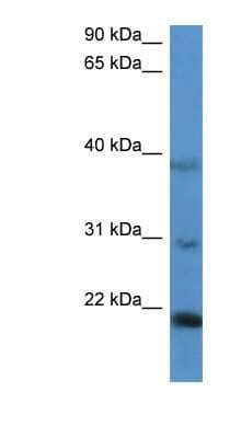 Western Blot: IMMP2L Antibody [NBP1-79838]