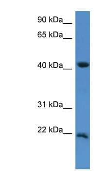 Western Blot: IMMP2L Antibody [NBP1-79839]