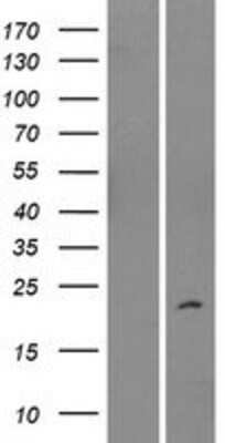 Western Blot: IMMP2L Overexpression Lysate [NBP2-06000]