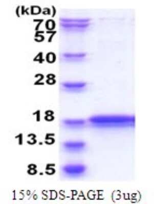 SDS-PAGE: Recombinant Human IMMP2L His Protein [NBP2-51812]