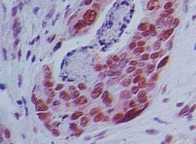 Immunohistochemistry-Paraffin: IMP Dehydrogenase 2/IMPDH2 Antibody [NBP2-27195]