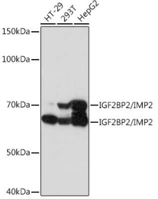 Western Blot: IMP2/IGF2BP2 Antibody (2O3W8) [NBP3-16585]