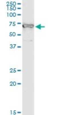 Immunoprecipitation: IMP2/IGF2BP2 Antibody (4C6) [H00010644-M01]