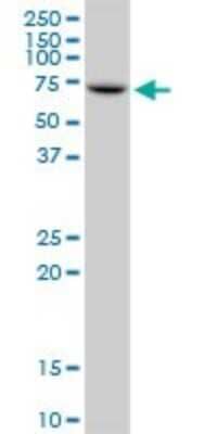 Western Blot: IMP2/IGF2BP2 Antibody (4C6) [H00010644-M01]