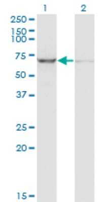 Western Blot: IMP2/IGF2BP2 Antibody (4C6) [H00010644-M01]