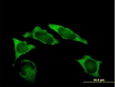 Immunocytochemistry/ Immunofluorescence: IMP2/IGF2BP2 Antibody [H00010644-B01P]