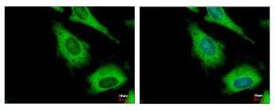 Immunocytochemistry/ Immunofluorescence: IMP2/IGF2BP2 Antibody [NBP1-33728]