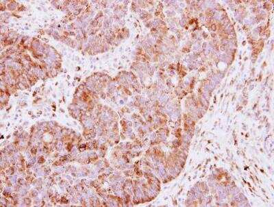 Immunohistochemistry-Paraffin: IMP2/IGF2BP2 Antibody [NBP1-33728]