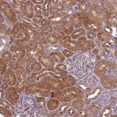 Immunohistochemistry-Paraffin: IMP2/IGF2BP2 Antibody [NBP2-33992]