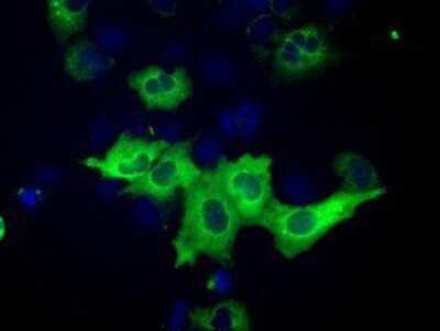 Immunocytochemistry/ Immunofluorescence: IMP2/IGF2BP2 Antibody (OTI3F9) - Azide and BSA Free [NBP2-71615]