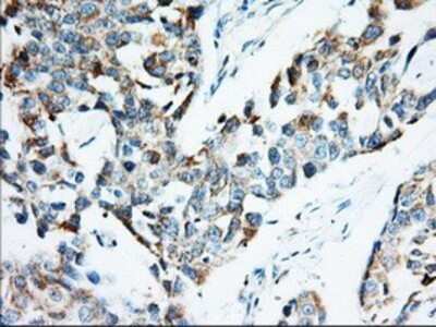Immunohistochemistry: IMP2/IGF2BP2 Antibody (OTI3F9) - Azide and BSA Free [NBP2-71615]