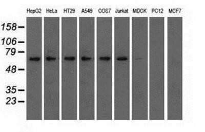 Western Blot: IMP2/IGF2BP2 Antibody (OTI3F9)Azide and BSA Free [NBP2-71615]