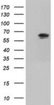 Western Blot: IMP2/IGF2BP2 Antibody (OTI3F9)Azide and BSA Free [NBP2-71615]