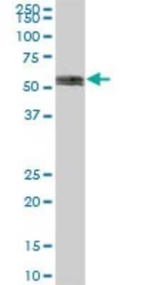 Western Blot: IMP2/IGF2BP2 Antibody [H00010644-B01P]