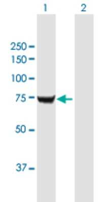 Western Blot: IMP2/IGF2BP2 Antibody [H00010644-B01P]