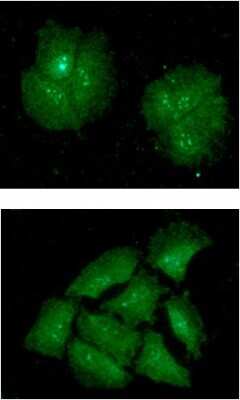 Immunocytochemistry/ Immunofluorescence: IMP3 Antibody (32E9) - BSA Free [NBP2-59475]