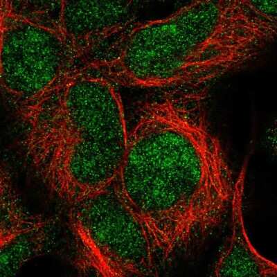 Immunocytochemistry/ Immunofluorescence: IMP3 Antibody [NBP2-56441]