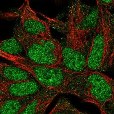 Immunocytochemistry/ Immunofluorescence: IMP3 Antibody [NBP2-56774]