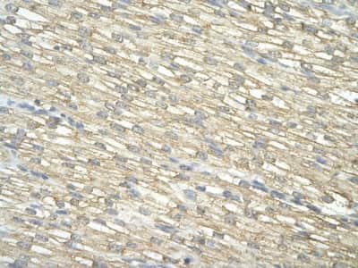 Immunohistochemistry: IMP3 Antibody [NBP1-57229]