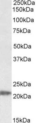 Western Blot: IMP3 Antibody [NBP1-49842]