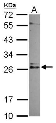 Western Blot: IMP3 Antibody [NBP2-16961]