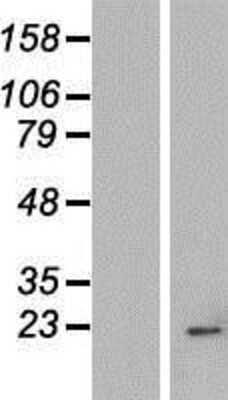 Western Blot: IMP3 Overexpression Lysate [NBP2-06811]