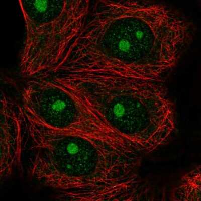 Immunocytochemistry/ Immunofluorescence: IMP4 Antibody [NBP2-55739]