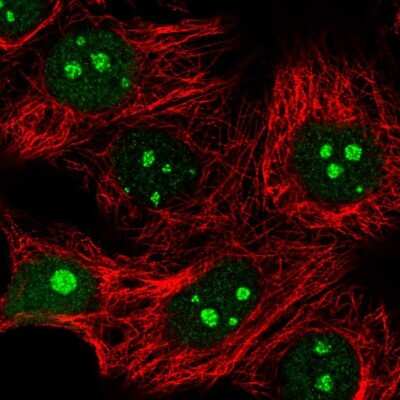 Immunocytochemistry/ Immunofluorescence: IMP4 Antibody [NBP2-56330]