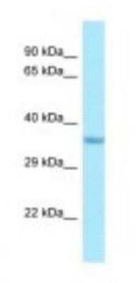 Western Blot: IMP4 Antibody [NBP1-98503]